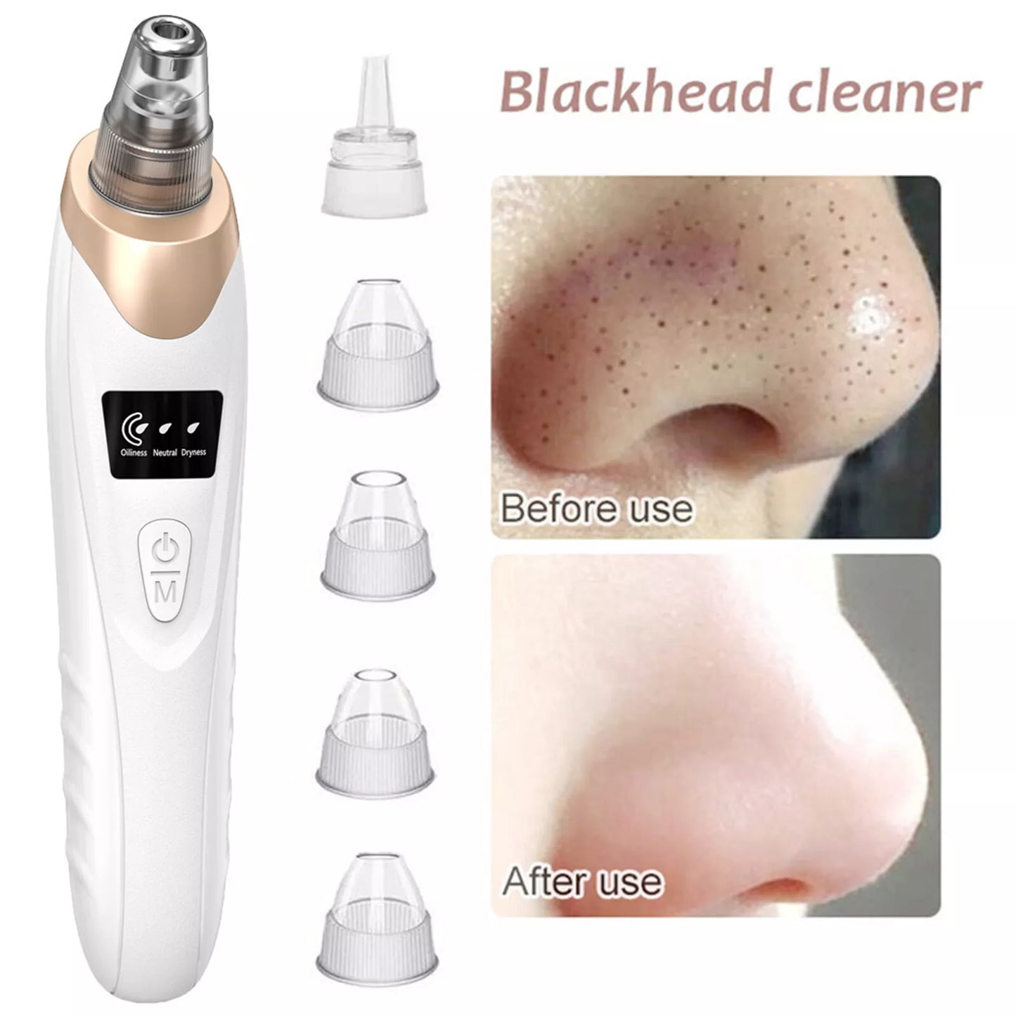 Pore Vacuum