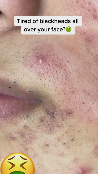 Pore Vacuum
